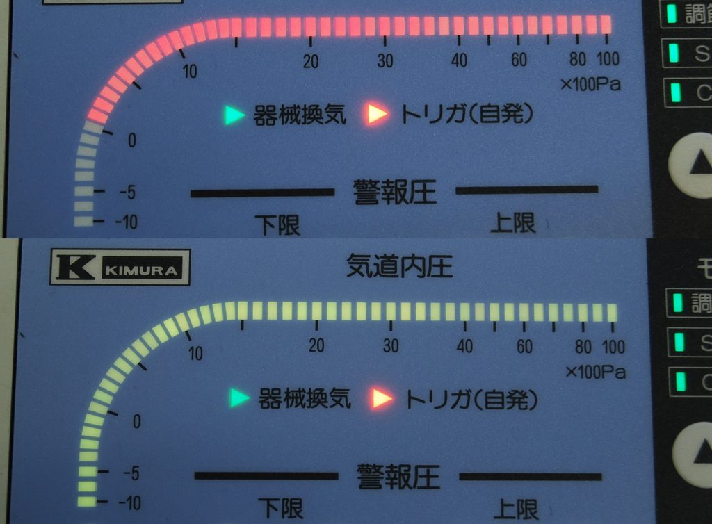 円形とリニア圧力メータ表示（2色）